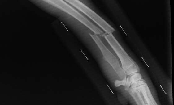 Liczy się efekt, a nie zamiary – odpowiedzialność za przestępstwa uszczerbku na zdrowiu