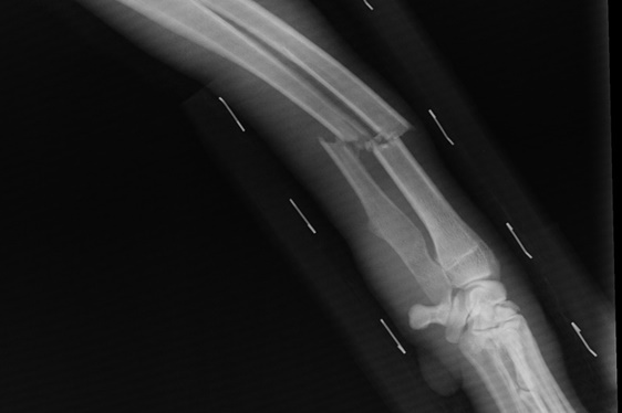 Liczy się efekt, a nie zamiary – odpowiedzialność za przestępstwa uszczerbku na zdrowiu